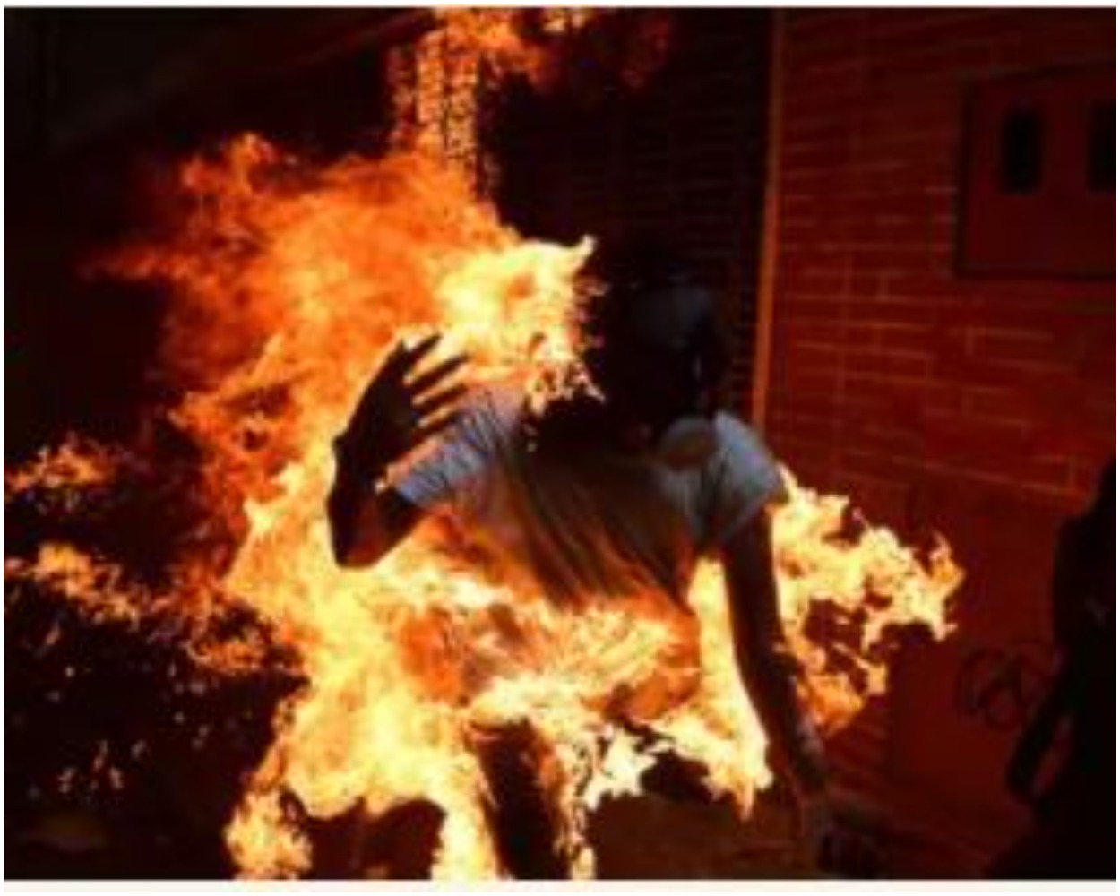 Kano student sets himself on Fire